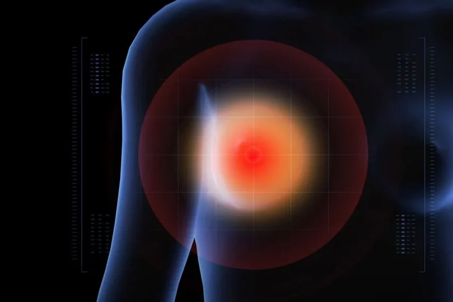 breast cancer target