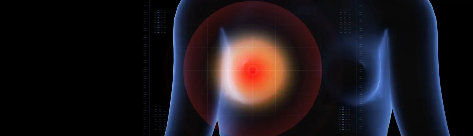 image of breast with target over it
