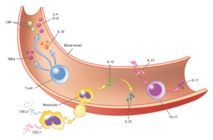 cross section of a blood vessel with a bacterial infection