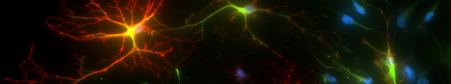 Primary cortical cultures from mouse brain. Cells that are stained green, yellow, and red are astrocytes. The nuclei of the cells are stained in blue (Hoechst stain) This is a 40X image taken using a Nikon epi-flourescent microscope. Courtesy of Johnson Lab.