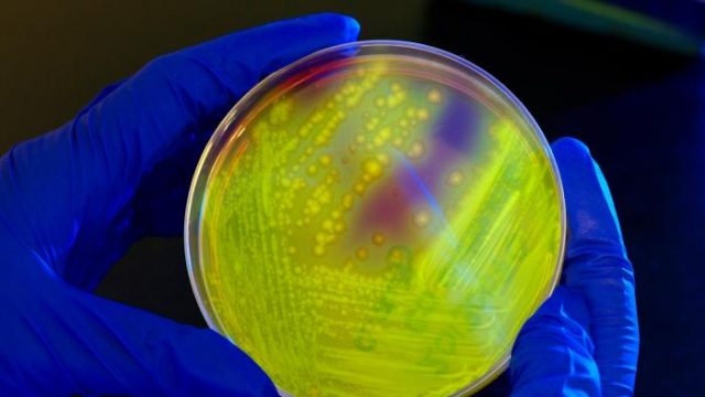 Image of Petri dish culture plate smeared with a Clostridium difficile bacterial culture which gave rise to numerous bacterial colonies. In this view, the plate is illuminated using long-wave UV irradiation. causing the bacterial colonies to emit a yellow-green, or chartreuse fluorescent glow.