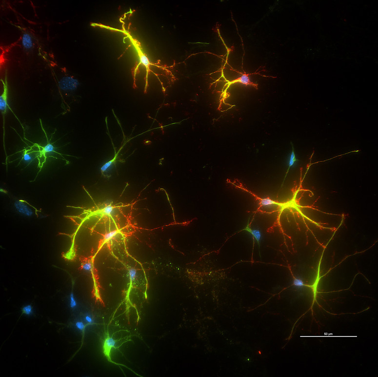 Yellow, green, and red light up the brain cells of a mouse model.