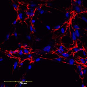 An image of PEG-FUD-Cy5 (shown in red) bound to extracellular matrix fibronectin assembled by fibroblasts that are growing on a glass slide (blue spheres in the photo). 