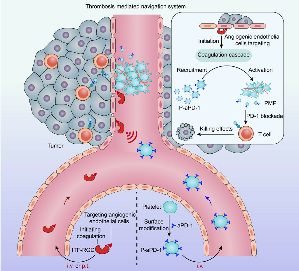 This schematic shows a two-step drug delivery approach to treating cancer tumors developed by UW–Madison researchers. On the left, engineered proteins (shown as red) initiate clotting at the site of a tumor before nanoparticles coated with a blood platelet membrane and loaded with an anti-cancer drug are injected and attracted to the clots within the tumor.