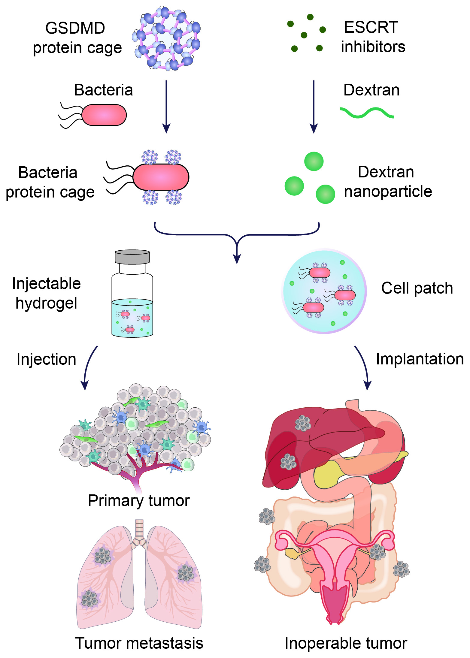 This schematic illustration shows Hu’s multipronged approach to improving immunotherapy for some cancers. The treatment relies on bacteria to deliver a protein (Gasdermin D) to trigger a form of cell death known as pyroptosis which elicits an immune response to the cancer. Another therapeutic encased in a tiny nanoparticle inhibits the cancer cells’ ability to repair themselves during pyroptosis.