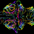 Colorful image of capillaries in the zebrafish brain (image by Michael Taylor)