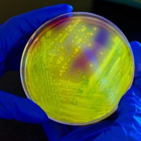 Image of Petri dish culture plate smeared with a Clostridium difficile bacterial culture which gave rise to numerous bacterial colonies. In this view, the plate is illuminated using long-wave UV irradiation. causing the bacterial colonies to emit a yellow-green, or chartreuse fluorescent glow.