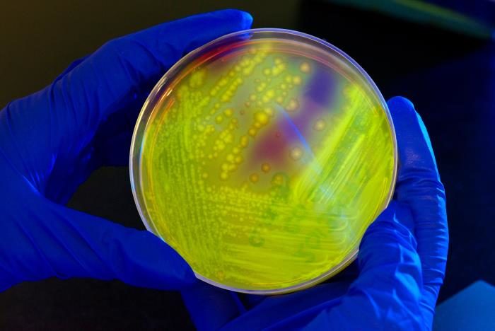 Image of Petri dish culture plate smeared with a Clostridium difficile bacterial culture which gave rise to numerous bacterial colonies. In this view, the plate is illuminated using long-wave UV irradiation. causing the bacterial colonies to emit a yellow-green, or chartreuse fluorescent glow.