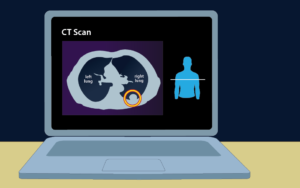 An illustration of a laptop showing a CT scan