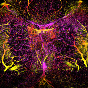 Breaking Down the Biology of the Brain’s Natural Barriers - School of ...